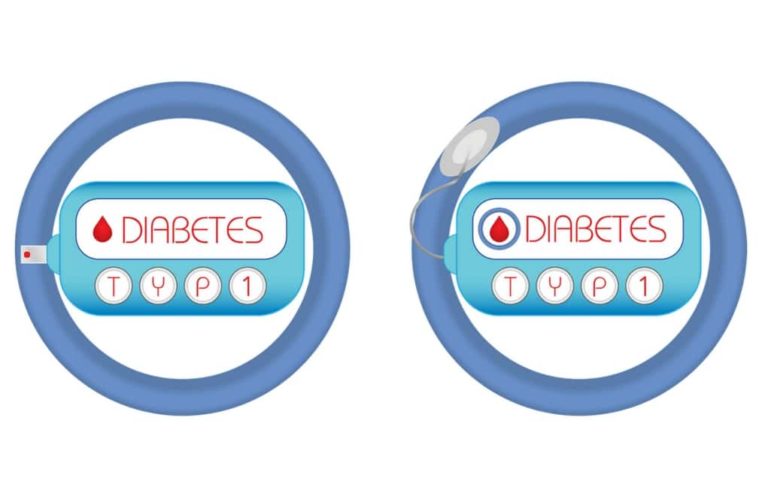 Der Diabetes Typ 1 wurde früher auch als Jugenddiabetes bezeichnet